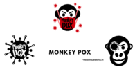 Signs and Symptoms | Mpox | Poxvirus||Mpox (Monkeypox): Causes, Symptoms, Treatment